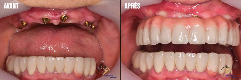 Photo soins dentaires