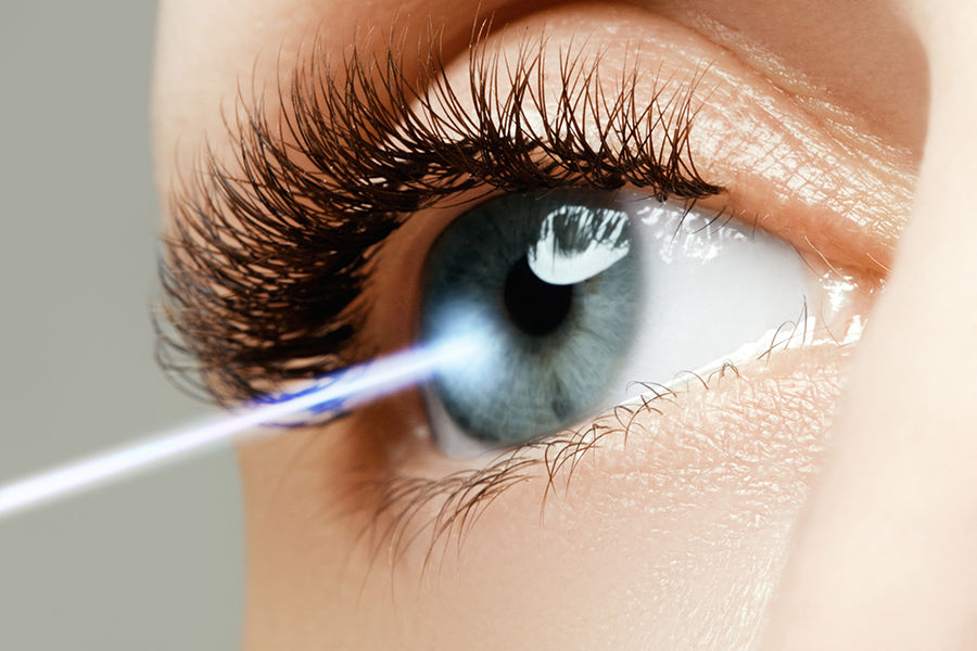 photo laser des yeux
