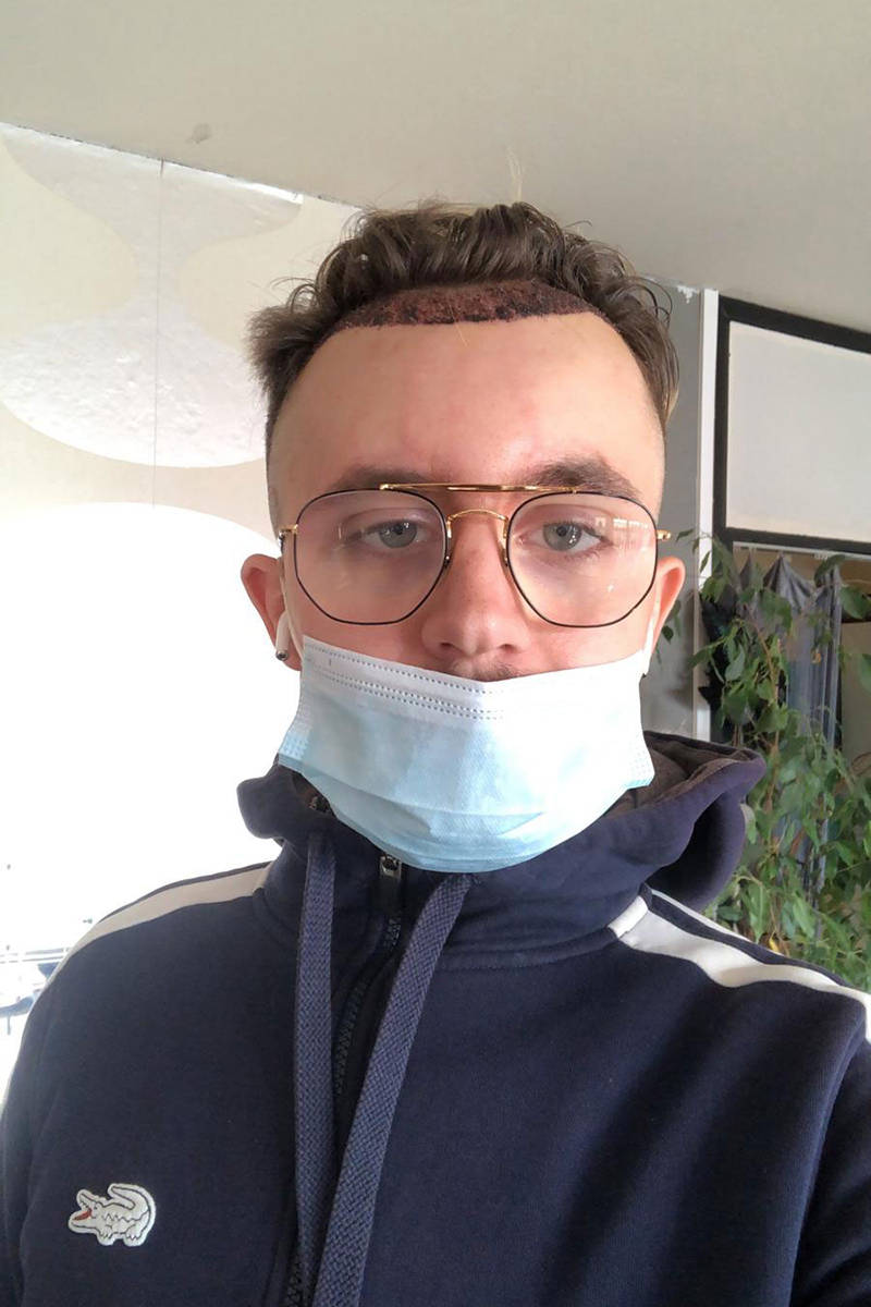 Après l'implantation