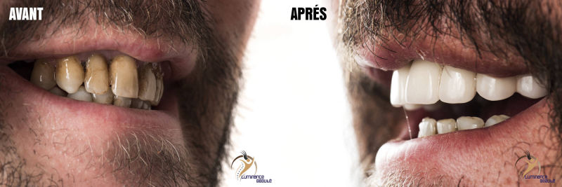 Photo soins dentaires