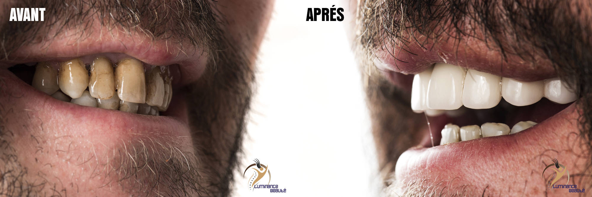 Photo soins dentaires
