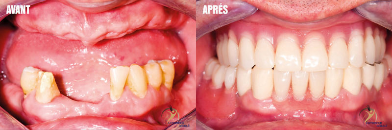 Photo soins dentaires