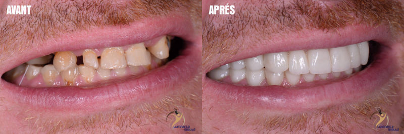Photo soins dentaires