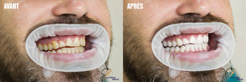 Photo soins dentaires