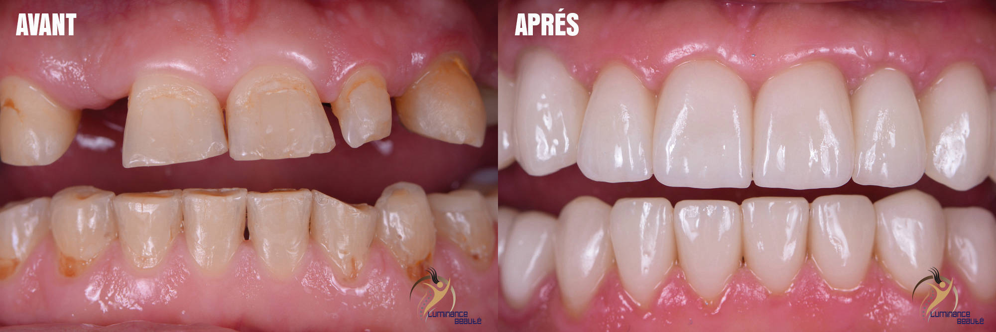 Photo soins dentaires
